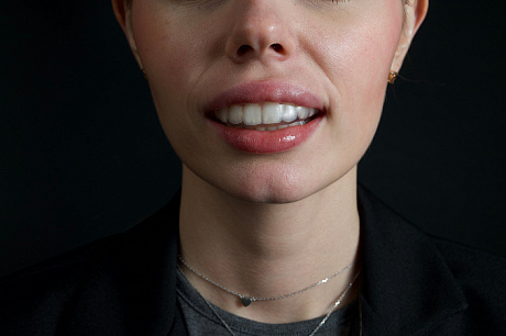 Капа для хоккея, регби и баскетбола